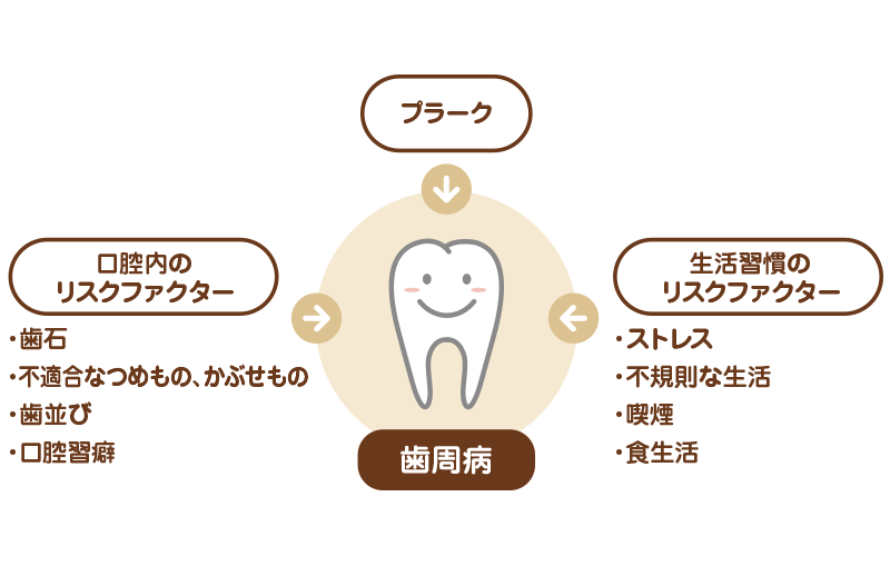 歯周病 歯槽膿漏 の治療 歯周病 歯槽膿漏 の治療 名古屋駅 名駅 の歯科 インプラント 矯正なら みやかわデンタルクリニック